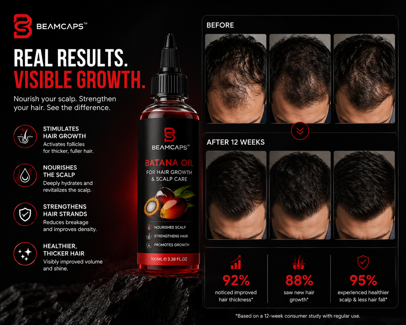 BeamCaps™ Growth Pro